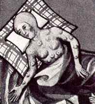 Рис. 209: Фрагмент иллюстрации Чёрной смерти из Тоггенбургской библии, 1411 г.