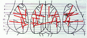 Рис. 238: Рисунок показывает некоторые из множества ран мозга крыс, нанесённых Лэшли.