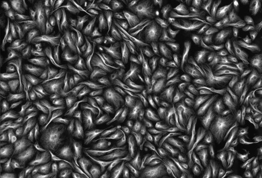 Microtubules