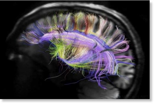 brain