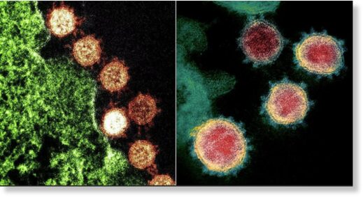 Вирусы SARS-CoV (слева) и SARS-CoV-2 (справа) под микроскопом. Согласно сразу нескольким работам, антитела к первому, имеющиеся у людей, которые переболели атипичной пневмонией, мешают SARS-CoV-2 проникать в клетки и распространяться по организму