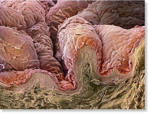 Кожа человека под микроскопом