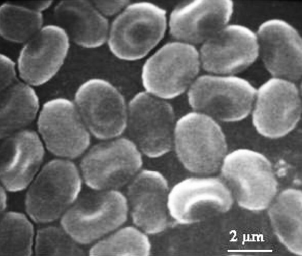 Electron Micrograph of Nosema bombycis​