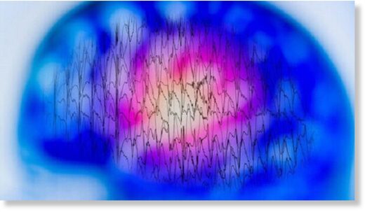 Впервые в мире исследователи записали мозговые волны умирающего пациента