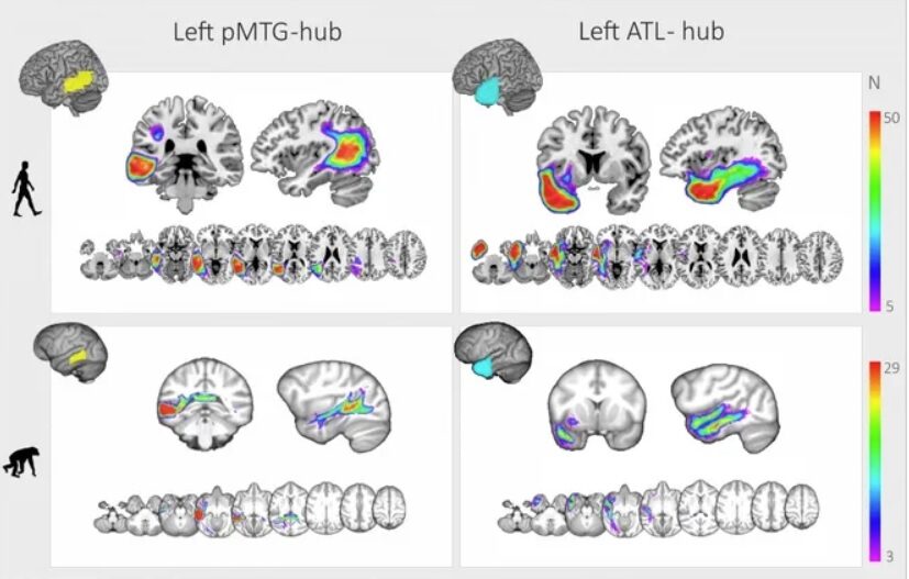 Сравнение языковых зон мозга человека и шимпанзе