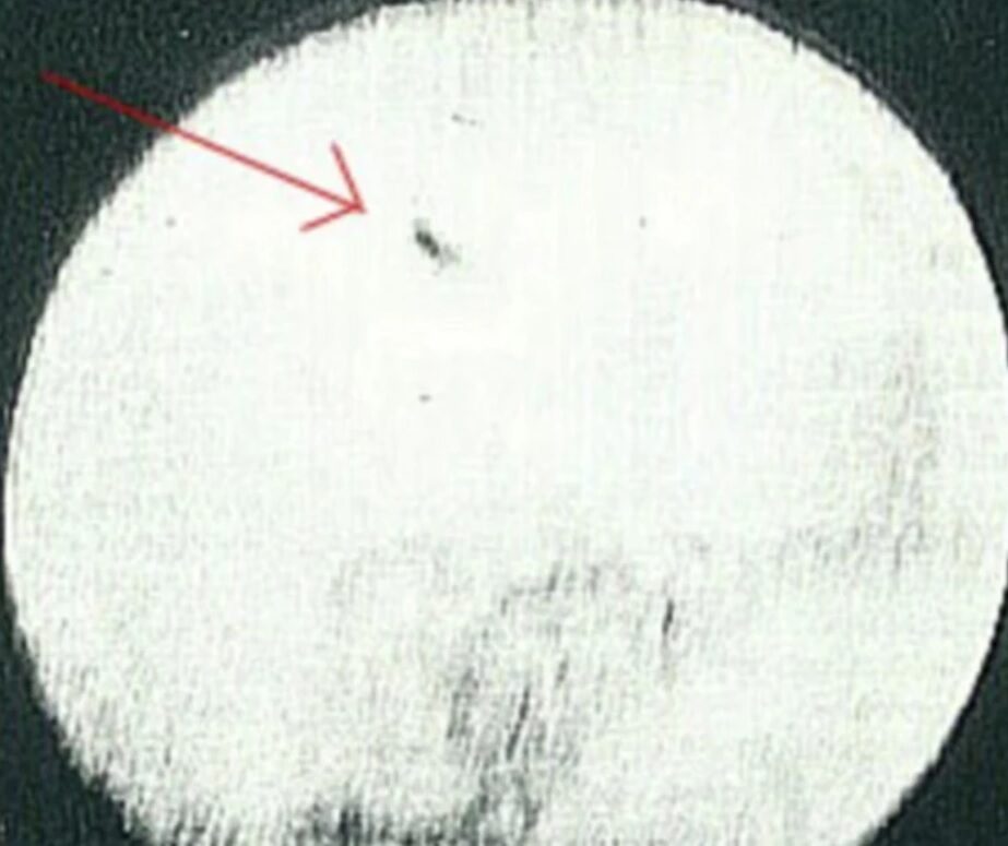 Тот самый снимок, сделанный мексиканским астрономом Хосе Бониллой Уфологи верят, что на фоне Солнца сняты «летающие тарелки»