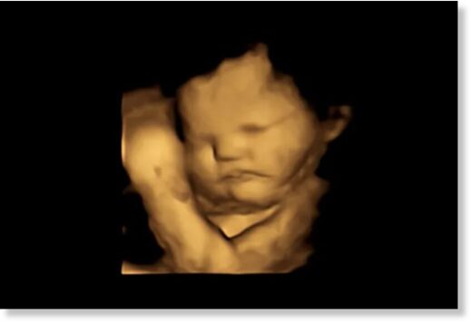 Нейтральное лицо младенца. FETAP (Fetal Taste Preferences) Study