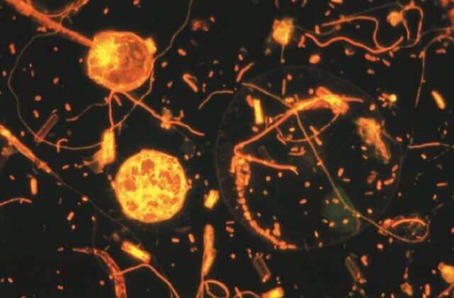 Microscope picture of psychrophilic (cold-loving) bacteria.​