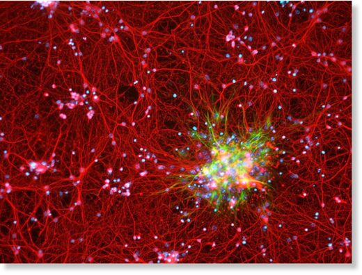 У астроцита (зеленый) и без того немало задач по обеспечению нормальной работы нейронов (красные), однако теперь к ним добавилась еще одна функция