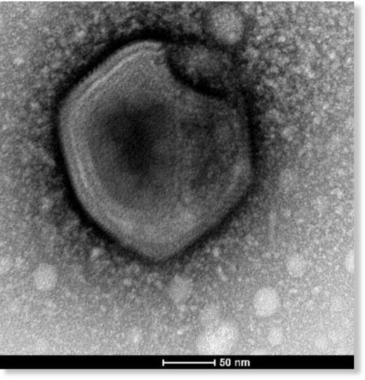 Один из гигантский вирусов, извлечённых из сибирской вечной мерзлоты. (Фото: Jean-Marie Alempic et al., Viruses, 2023.)