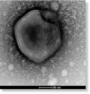 Один из гигантский вирусов, извлечённых из сибирской вечной мерзлоты. (Фото: Jean-Marie Alempic et al., Viruses, 2023.)