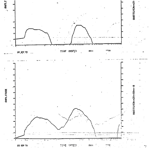 United States Government Light patterns detected by the Vela satellite 6911​