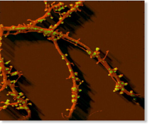 Выращенный в клеточной культуре гиппокампальный нейрон с выступами-шипиками (окрашены зелёным) в тех местах дендритного отростка, где он готов образовать синапсы с другими нейронами.